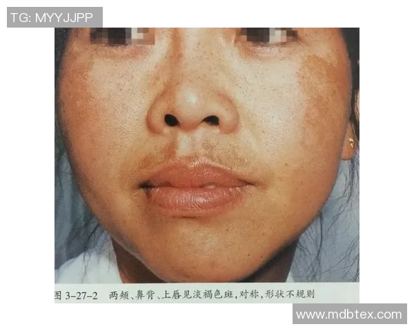 姚明的下颚与篮球生涯的关系探讨及其对运动员形象的影响分析